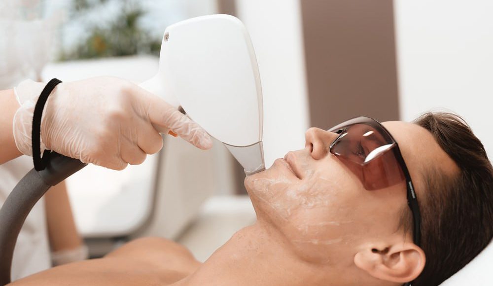 Gent’s Laser Hair Removal (Face)