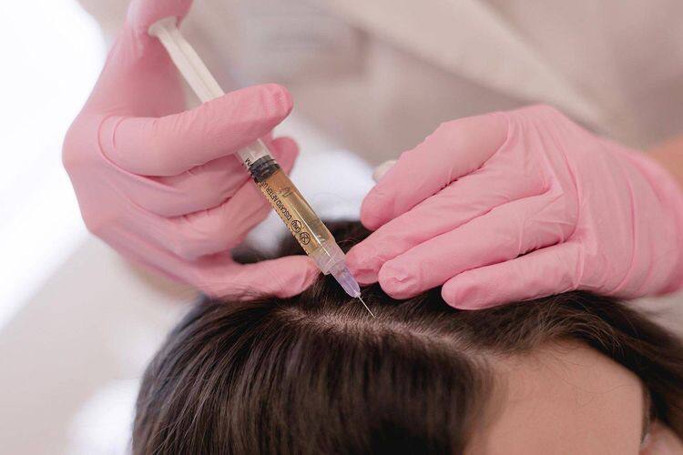 Mesotherapy (Hair loss, skin rejuvenation and fat dissolving)